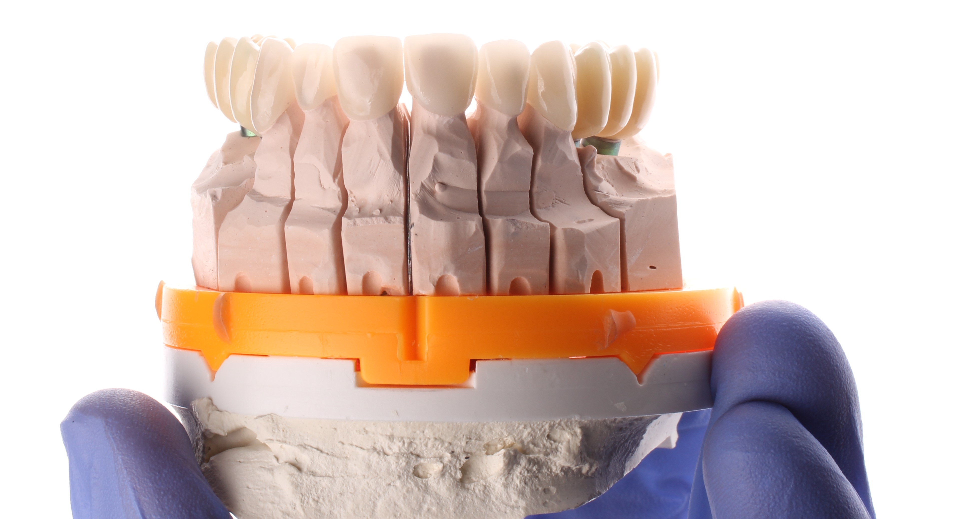 Несъёмные решения