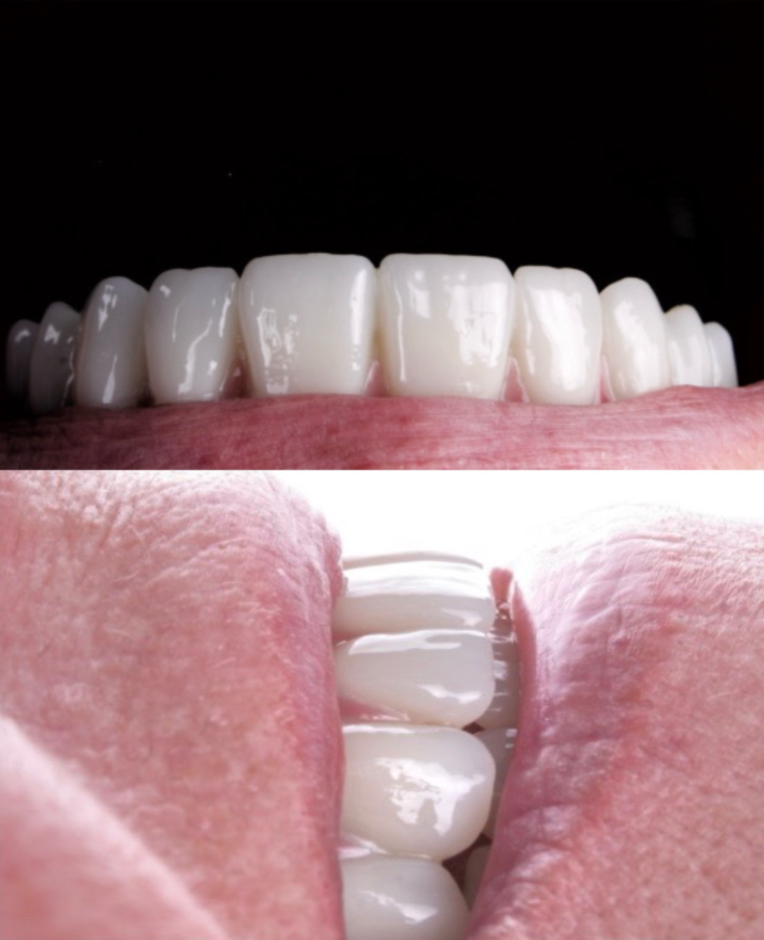 Тотальная реабилитация