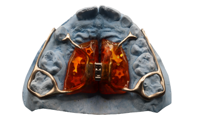 Ортодонтия с VVVLAB